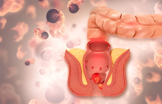 Ayurvedic treatment for piles